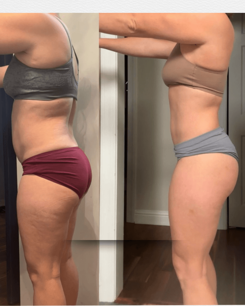 Female client body recomposition side view progress